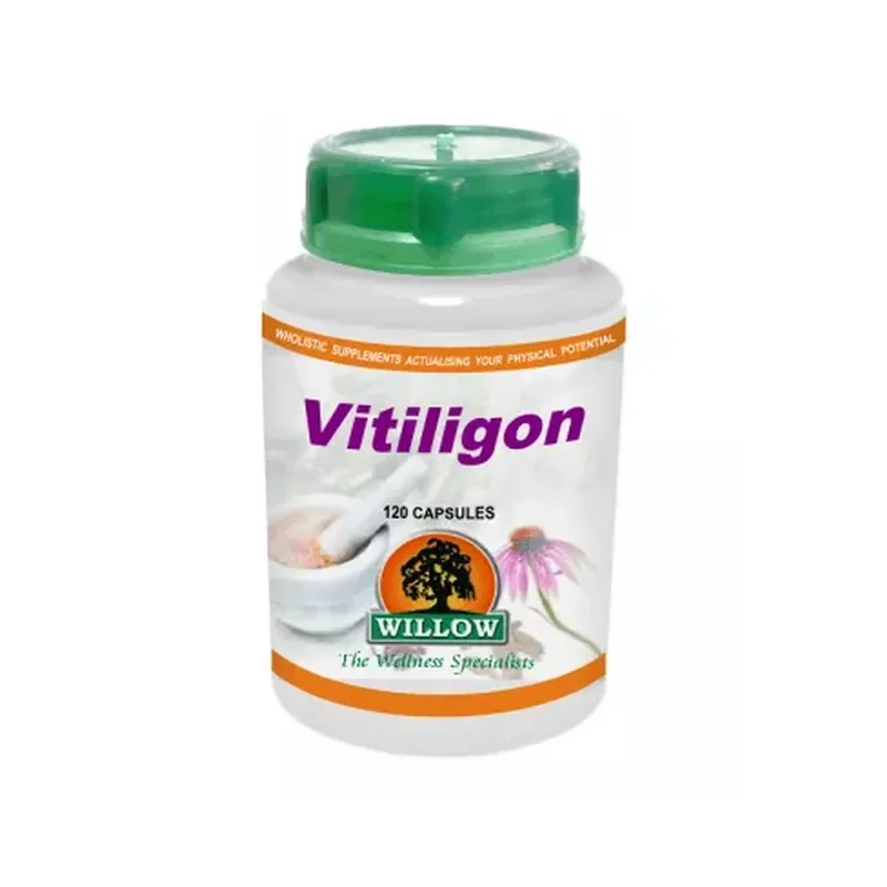 Vitiligon 120